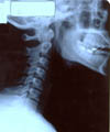 X-ray Image 1