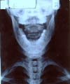 X-ray Image 2